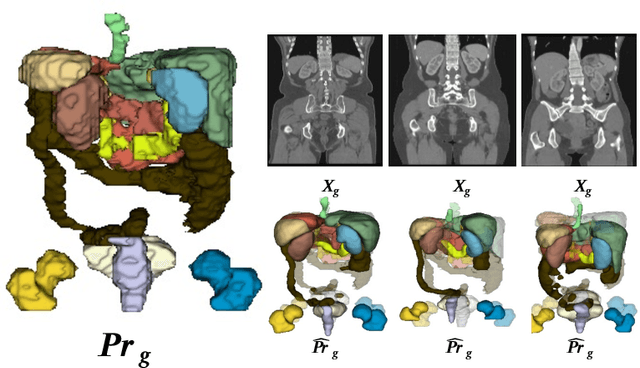 Figure 4 for AIC-UNet: Anatomy-informed Cascaded UNet for Robust Multi-Organ Segmentation