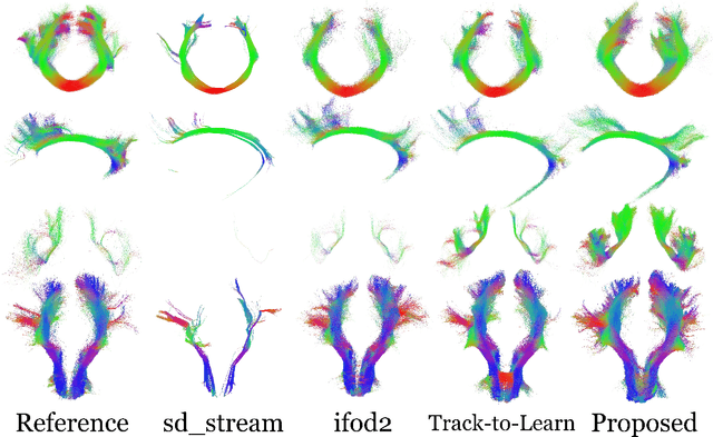 Figure 2 for TractOracle: towards an anatomically-informed reward function for RL-based tractography
