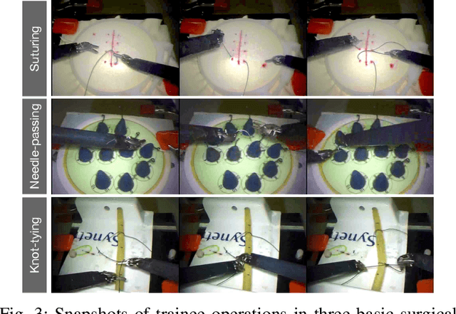 Figure 3 for Uncertainty-aware Self-supervised Learning for Cross-domain Technical Skill Assessment in Robot-assisted Surgery