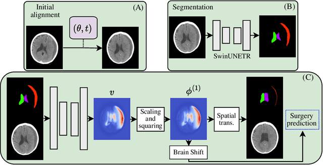 Figure 3 for Brain-Shift: Unsupervised Pseudo-Healthy Brain Synthesis for Novel Biomarker Extraction in Chronic Subdural Hematoma
