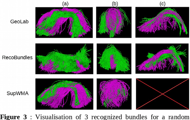 Figure 4 for GeoLab: Geometry-based Tractography Parcellation of Superficial White Matter