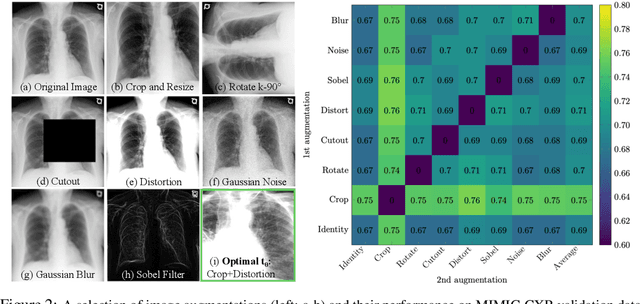 Figure 4 for Exploring Image Augmentations for Siamese Representation Learning with Chest X-Rays