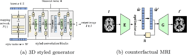 Figure 3 for Causal Image Synthesis of Brain MR in 3D