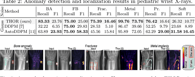 Figure 4 for Diffusion Models with Implicit Guidance for Medical Anomaly Detection