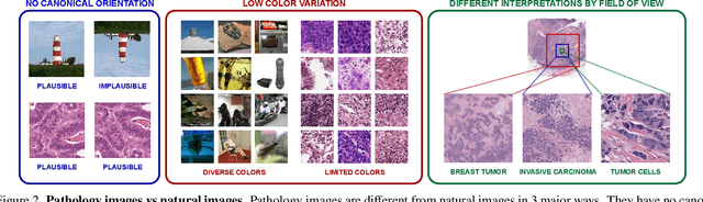 Figure 2 for Benchmarking Self-Supervised Learning on Diverse Pathology Datasets