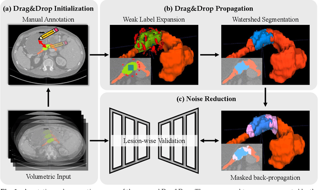 Figure 1 for Acquiring Weak Annotations for Tumor Localization in Temporal and Volumetric Data
