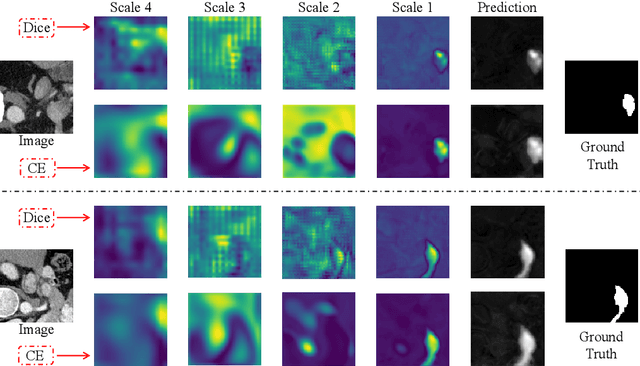 Figure 4 for Discrepancy Matters: Learning from Inconsistent Decoder Features for Consistent Semi-supervised Medical Image Segmentation