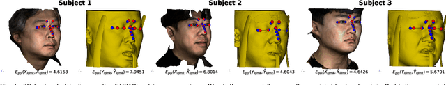 Figure 4 for Automatic 3D Registration of Dental CBCT and Face Scan Data using 2D Projection images