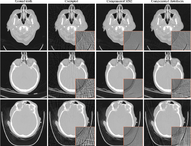 Figure 4 for Gradient-Based Geometry Learning for Fan-Beam CT Reconstruction