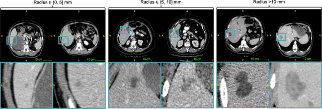 Figure 1 for Label-Free Liver Tumor Segmentation