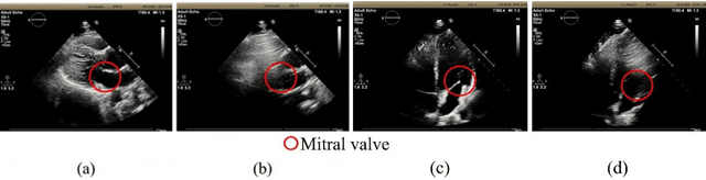 Figure 4 for Diagnostic Posture Control System for Seated-Style Echocardiography Robot