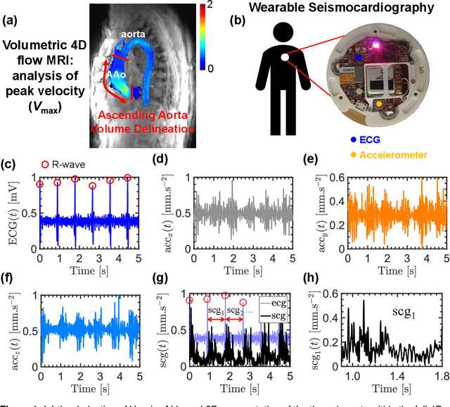 Figure 1 for A deep learning approach to using wearable seismocardiography (SCG) for diagnosing aortic valve stenosis and predicting aortic hemodynamics obtained by 4D flow MRI