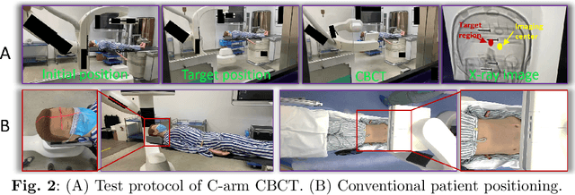 Figure 3 for Automating Catheterization Labs with Real-Time Perception