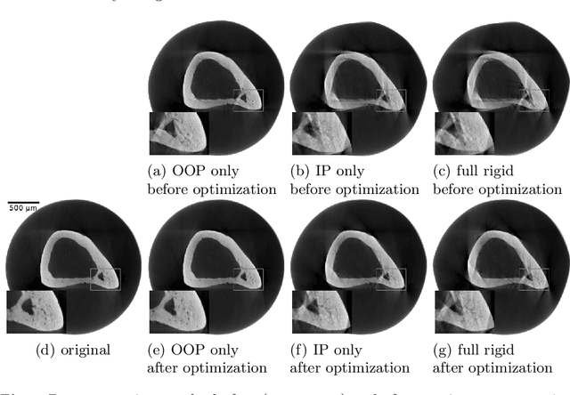 Figure 3 for Motion Compensation via Epipolar Consistency for In-Vivo X-Ray Microscopy