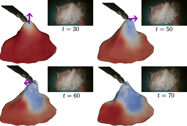 Figure 1 for Real-to-Sim Deformable Object Manipulation: Optimizing Physics Models with Residual Mappings for Robotic Surgery