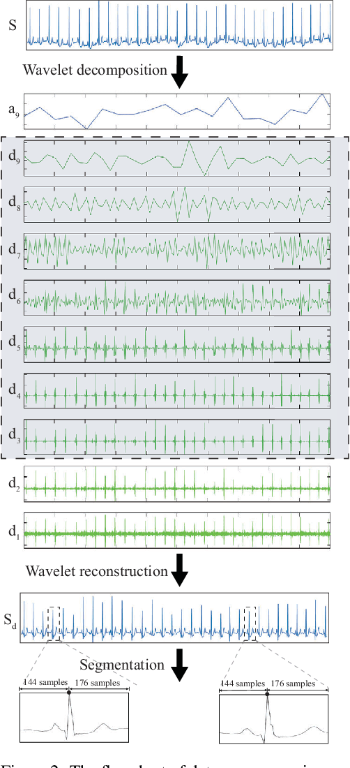 Figure 3 for Interpretable Tsetlin Machine-based Premature Ventricular Contraction Identification