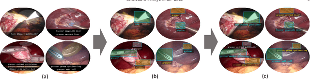 Figure 1 for CholecTriplet2022: Show me a tool and tell me the triplet -- an endoscopic vision challenge for surgical action triplet detection