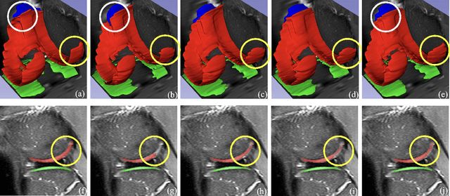 Figure 4 for Dealing With Heterogeneous 3D MR Knee Images: A Federated Few-Shot Learning Method With Dual Knowledge Distillation