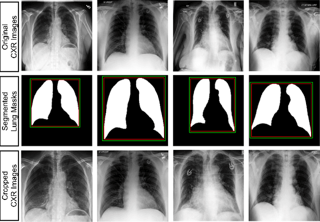 Figure 2 for Learning to Generalize towards Unseen Domains via a Content-Aware Style Invariant Framework for Disease Detection from Chest X-rays