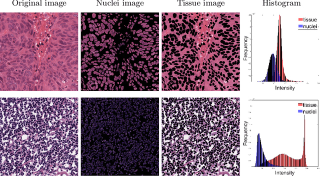 Figure 3 for Improving Generalization Capability of Deep Learning-Based Nuclei Instance Segmentation by Non-deterministic Train Time and Deterministic Test Time Stain Normalization