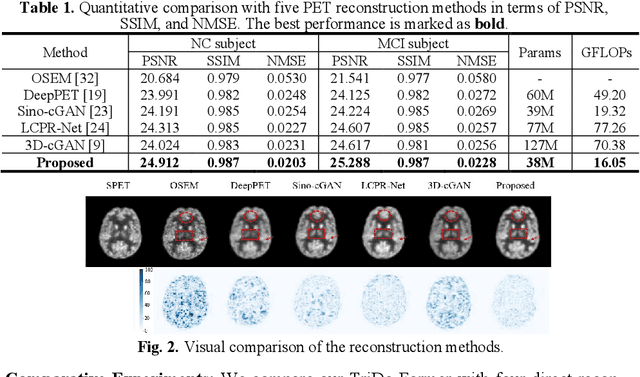 Figure 2 for TriDo-Former: A Triple-Domain Transformer for Direct PET Reconstruction from Low-Dose Sinograms