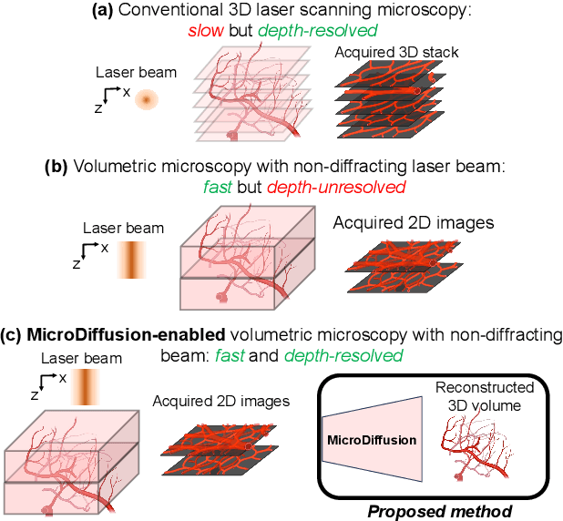 Figure 1 for MicroDiffusion: Implicit Representation-Guided Diffusion for 3D Reconstruction from Limited 2D Microscopy Projections