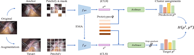 Figure 1 for Self-Supervised Learning for Endoscopic Video Analysis