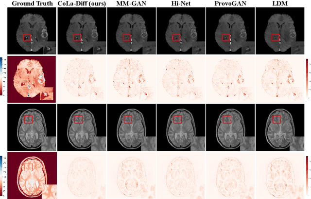 Figure 3 for CoLa-Diff: Conditional Latent Diffusion Model for Multi-Modal MRI Synthesis