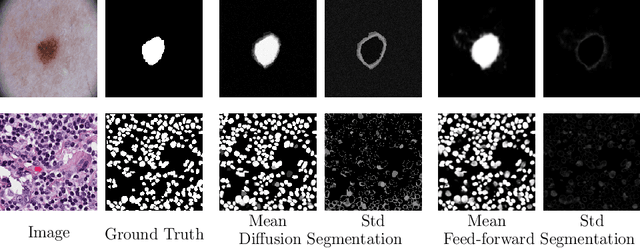 Figure 2 for Analysing Diffusion Segmentation for Medical Images
