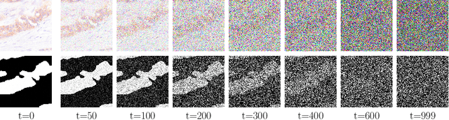 Figure 3 for Analysing Diffusion Segmentation for Medical Images