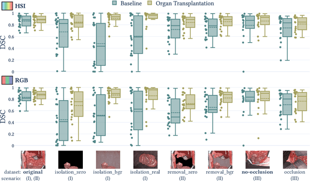 Figure 3 for Semantic segmentation of surgical hyperspectral images under geometric domain shifts