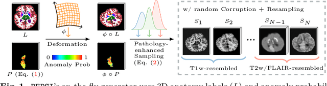 Figure 1 for PEPSI: Pathology-Enhanced Pulse-Sequence-Invariant Representations for Brain MRI