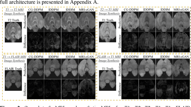 Figure 3 for Cycle-guided Denoising Diffusion Probability Model for 3D Cross-modality MRI Synthesis