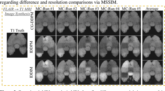 Figure 4 for Cycle-guided Denoising Diffusion Probability Model for 3D Cross-modality MRI Synthesis