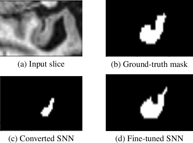 Figure 3 for Hybrid Spiking Neural Network Fine-tuning for Hippocampus Segmentation