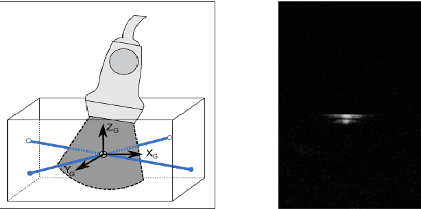 Figure 3 for Freehand 2D Ultrasound Probe Calibration for Image Fusion with 3D MRI/CT