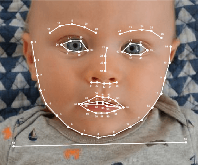 Figure 2 for Automatic Assessment of Infant Face and Upper-Body Symmetry as Early Signs of Torticollis