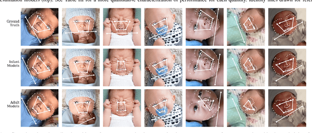 Figure 4 for Automatic Assessment of Infant Face and Upper-Body Symmetry as Early Signs of Torticollis