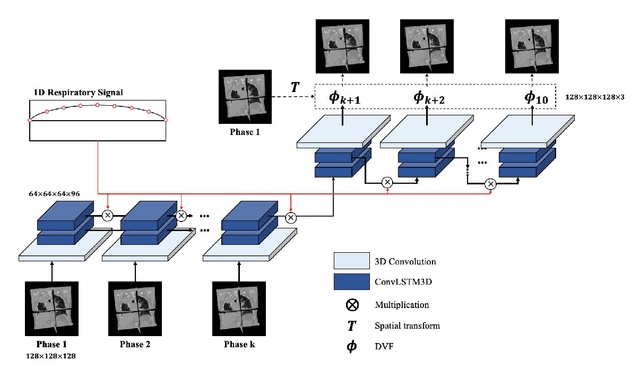 Figure 1 for RMSim: Controlled Respiratory Motion Simulation on Static Patient Scans