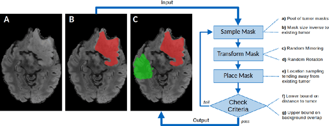 Figure 1 for The Brain Tumor Segmentation (BraTS) Challenge 2023: Local Synthesis of Healthy Brain Tissue via Inpainting