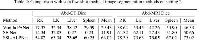 Figure 4 for DenseMP: Unsupervised Dense Pre-training for Few-shot Medical Image Segmentation