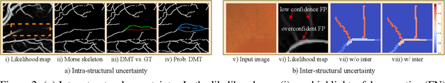 Figure 3 for Topology-Aware Uncertainty for Image Segmentation