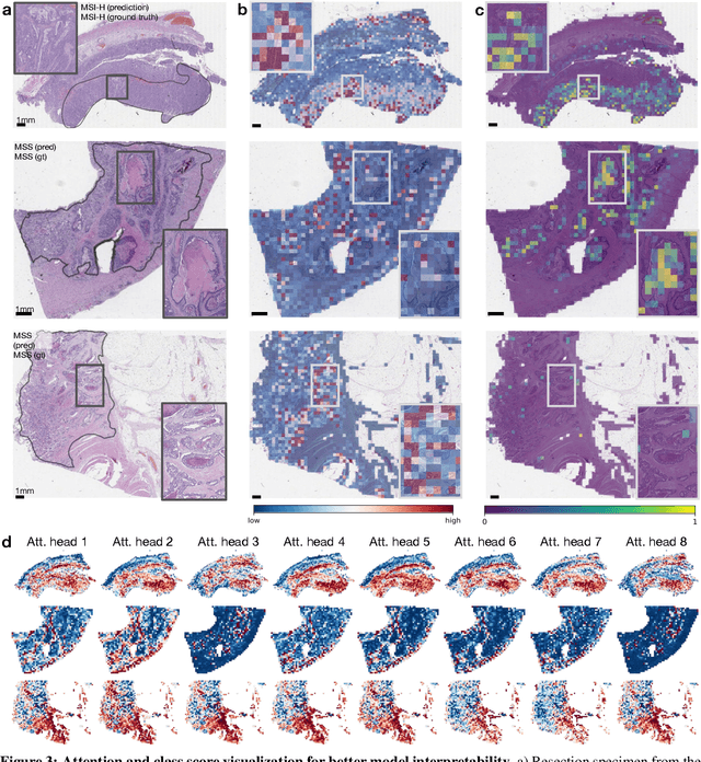 Figure 3 for Fully transformer-based biomarker prediction from colorectal cancer histology: a large-scale multicentric study