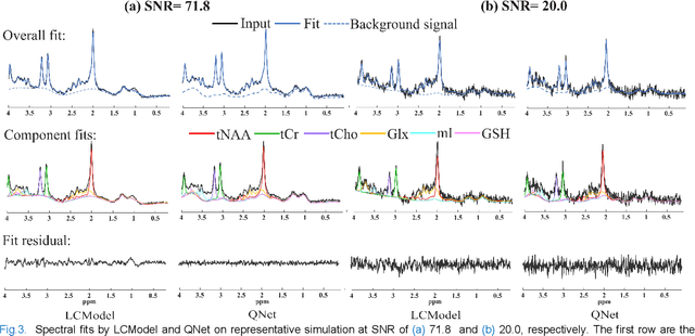 Figure 4 for Magnetic Resonance Spectroscopy Quantification Aided by Deep Estimations of Imperfection Factors and Overall Macromolecular Signal