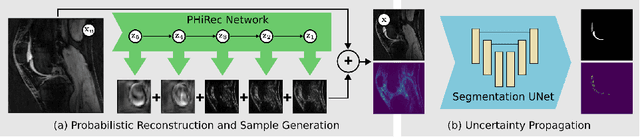 Figure 1 for Uncertainty Estimation and Propagation in Accelerated MRI Reconstruction