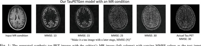 Figure 1 for TauPETGen: Text-Conditional Tau PET Image Synthesis Based on Latent Diffusion Models