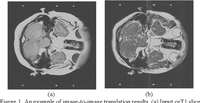 Figure 1 for Unsupervised Domain Adaptation for MRI Volume Segmentation and Classification Using Image-to-Image Translation