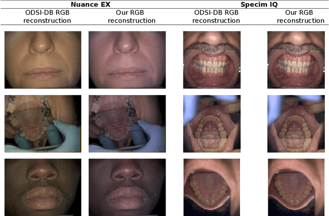 Figure 1 for Hyperspectral Image Segmentation: A Preliminary Study on the Oral and Dental Spectral Image Database (ODSI-DB)