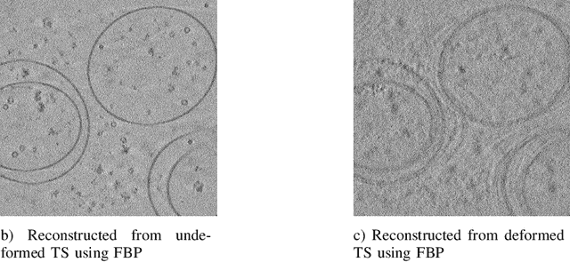Figure 1 for Ice-Tide: Implicit Cryo-ET Imaging and Deformation Estimation