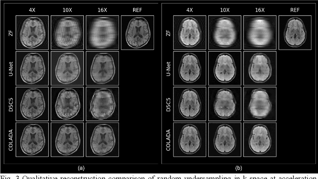 Figure 4 for Contrastive Learning MRI Reconstruction